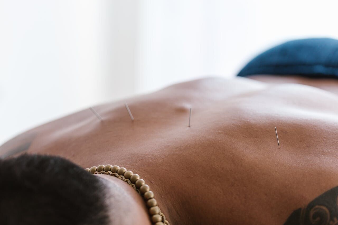 Acupuncture proves to be safe and effective for chronic back pain